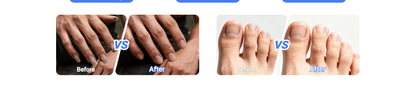 Universal Automatic Fingernail Grinder for Adults and Children